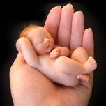 preterm[1]